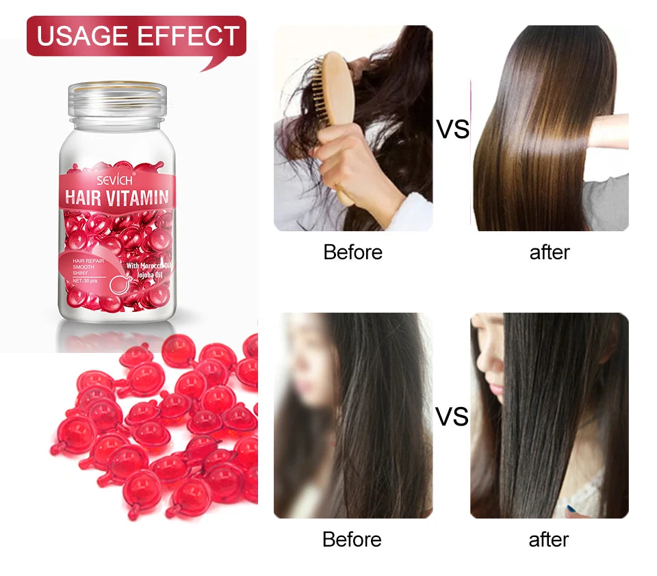 30pcs Sevich Hair Vitamin Capsules – Keratin Complex Oil for Hair Loss, Frizz Repair & Silky Smooth Hair